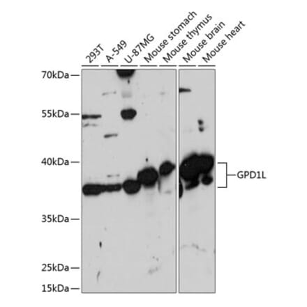 Western Blot - Anti-GPD1L Antibody (A89641) - Antibodies.com