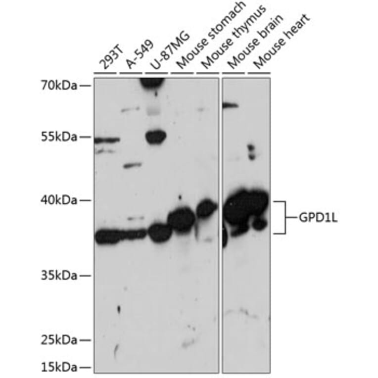Western Blot - Anti-GPD1L Antibody (A89641) - Antibodies.com