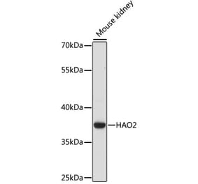 Western Blot - Anti-HAO2 Antibody (A89642) - Antibodies.com