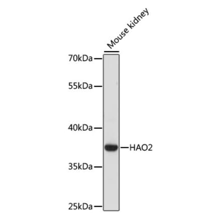 Western Blot - Anti-HAO2 Antibody (A89642) - Antibodies.com