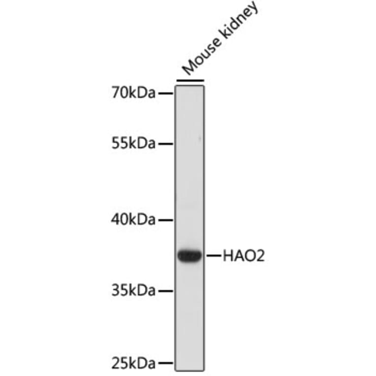 Western Blot - Anti-HAO2 Antibody (A89642) - Antibodies.com