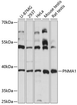 Western blot analysis of extracts of various cell lines, using Anti-PNMA1 Antibody (A14558) at 1:3000 dilution.
Secondary antibody: Goat Anti-Rabbit IgG (H+L) (HRP) (AS014) at 1:10,000 dilution.
Lysates / proteins: 25µg per lane.
Blocking buffer: 3% non-fat dry milk in TBST.
Detection: ECL Basic Kit (RM00020).
Exposure time: 15s.