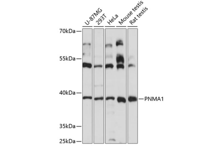 Western Blot - Anti-PNMA1 Antibody (A89643) - Antibodies.com