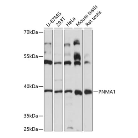 Western Blot - Anti-PNMA1 Antibody (A89643) - Antibodies.com