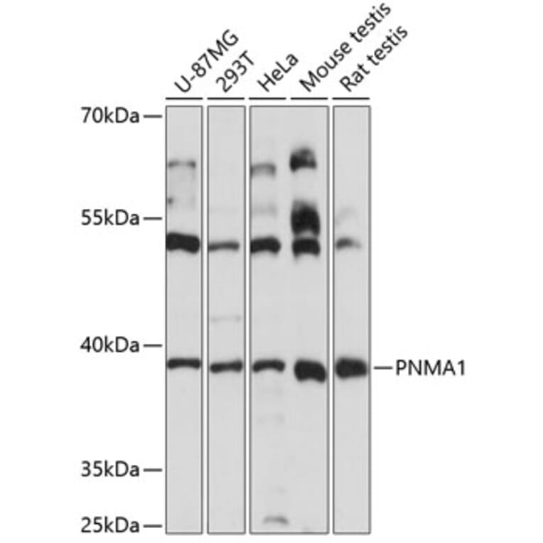 Western Blot - Anti-PNMA1 Antibody (A89643) - Antibodies.com