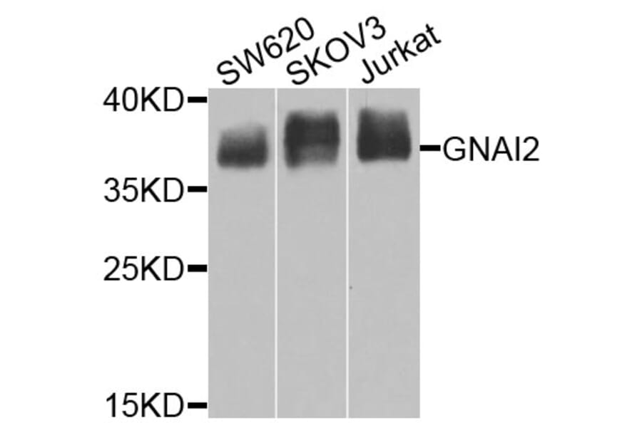 Western Blot - Anti-GNAI2 Antibody (A14204) - Antibodies.com