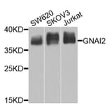 Western Blot - Anti-GNAI2 Antibody (A14204) - Antibodies.com