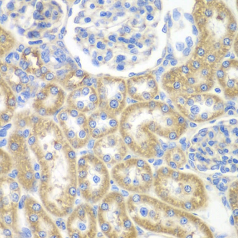 Immunohistochemistry - Anti-GNAI2 Antibody (A14204) - Antibodies.com