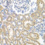 Immunohistochemistry - Anti-GNAI2 Antibody (A14204) - Antibodies.com