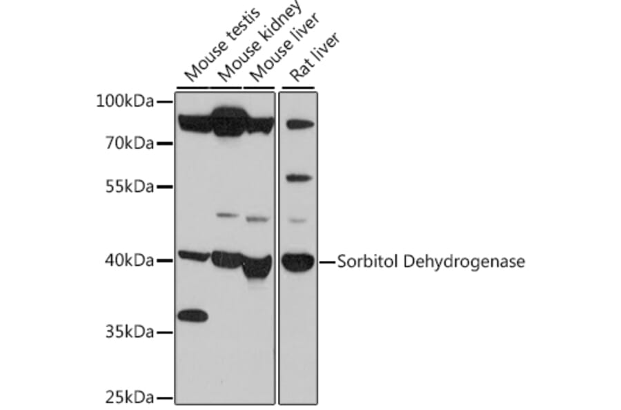 Western Blot - Anti-Sorbitol Dehydrogenase Antibody (A89645) - Antibodies.com