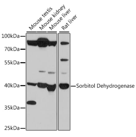Western Blot - Anti-Sorbitol Dehydrogenase Antibody (A89645) - Antibodies.com
