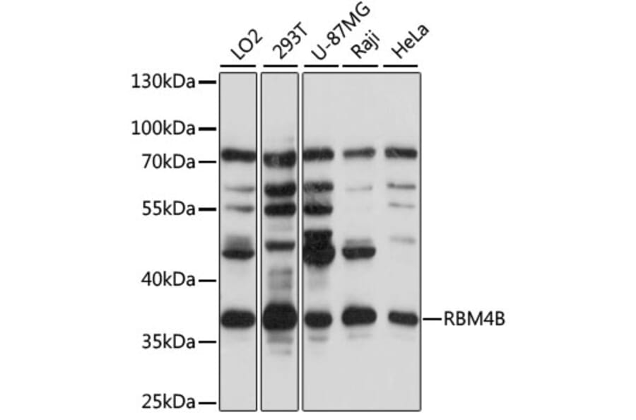 Western Blot - Anti-RBM4B Antibody (A89646) - Antibodies.com
