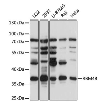 Western Blot - Anti-RBM4B Antibody (A89646) - Antibodies.com