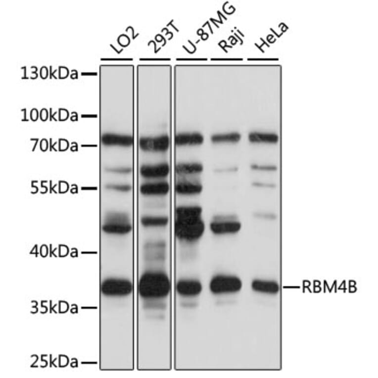 Western Blot - Anti-RBM4B Antibody (A89646) - Antibodies.com
