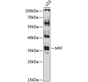 Western Blot - Anti-MFF Antibody (A89647) - Antibodies.com