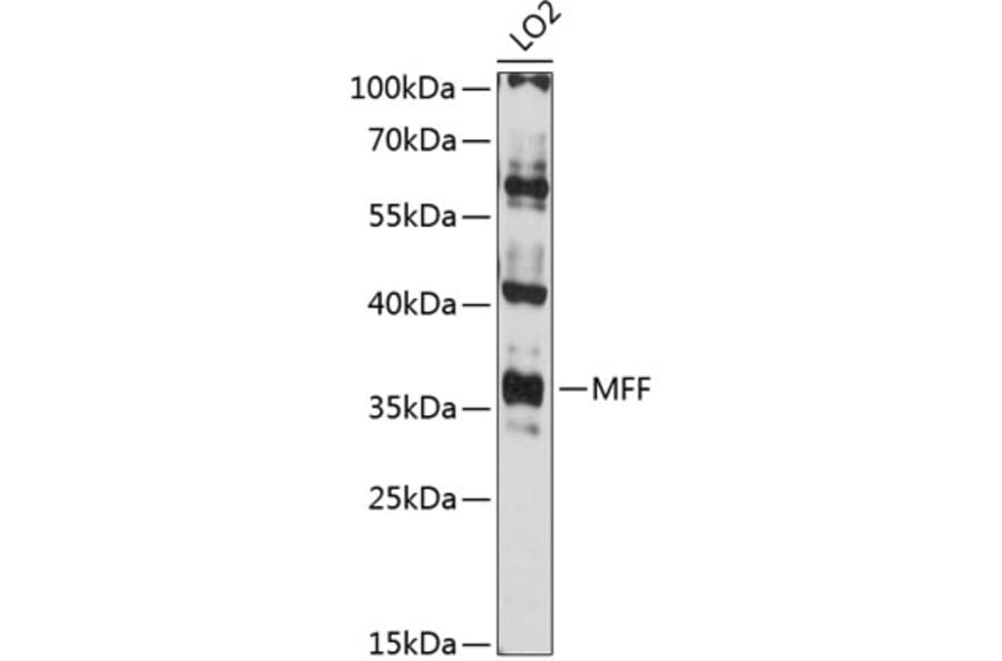 Western Blot - Anti-MFF Antibody (A89647) - Antibodies.com