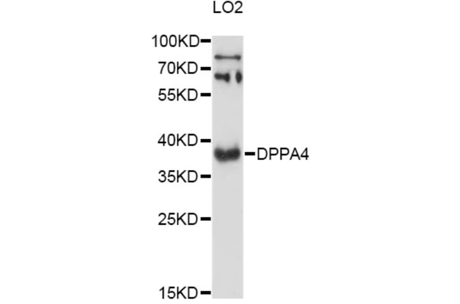 Western Blot - Anti-DPPA4 Antibody (A13725) - Antibodies.com