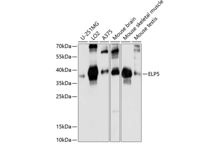 Western Blot - Anti-C17orf81 Antibody (A89650) - Antibodies.com