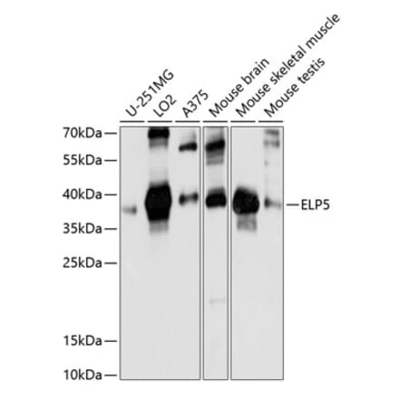 Western Blot - Anti-C17orf81 Antibody (A89650) - Antibodies.com