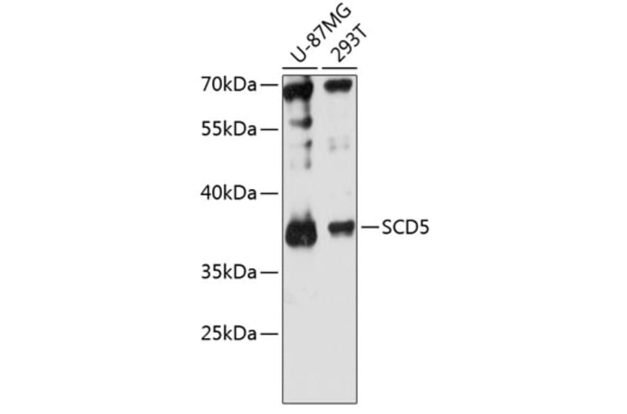 Western Blot - Anti-SCD5 Antibody (A89651) - Antibodies.com
