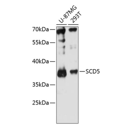 Western Blot - Anti-SCD5 Antibody (A89651) - Antibodies.com