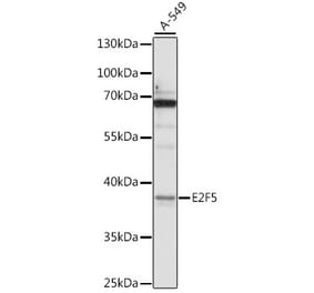 Western Blot - Anti-E2F5 Antibody (A89652) - Antibodies.com