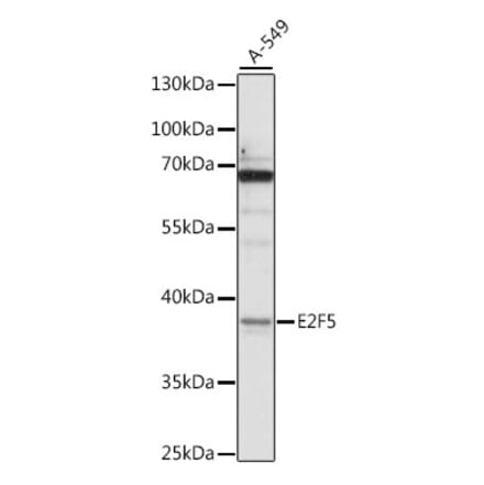 Western Blot - Anti-E2F5 Antibody (A89652) - Antibodies.com