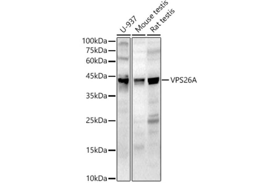 Western Blot - Anti-VPS26 Antibody (A89653) - Antibodies.com