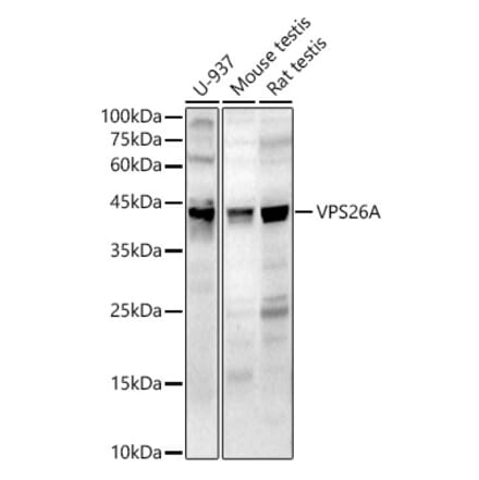 Western Blot - Anti-VPS26 Antibody (A89653) - Antibodies.com