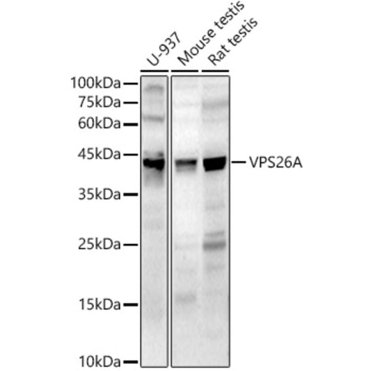 Western Blot - Anti-VPS26 Antibody (A89653) - Antibodies.com