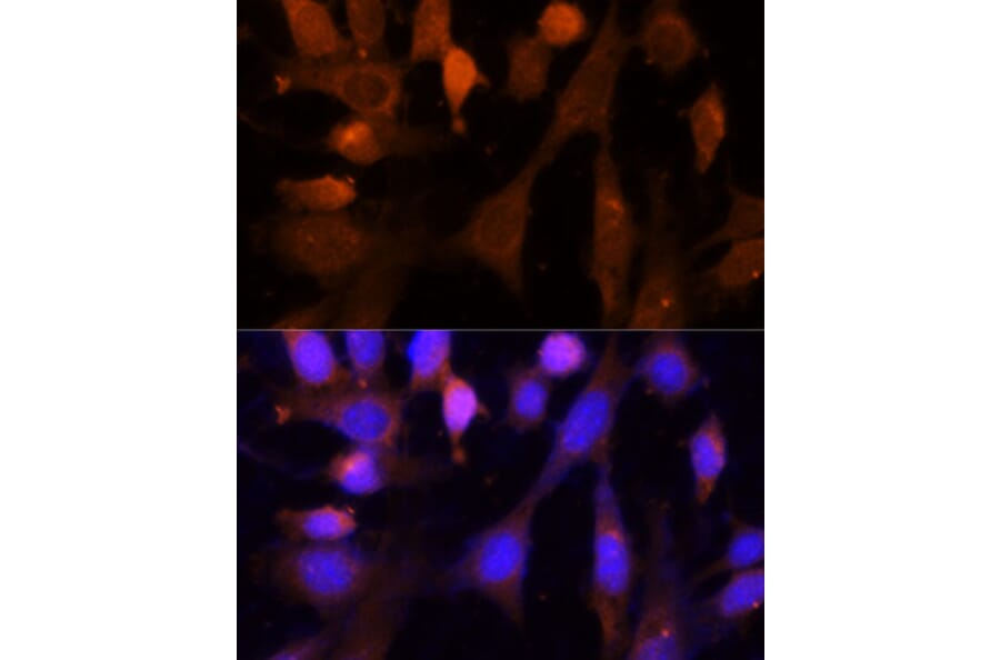 Immunofluorescence - Anti-VPS26 Antibody (A89653) - Antibodies.com