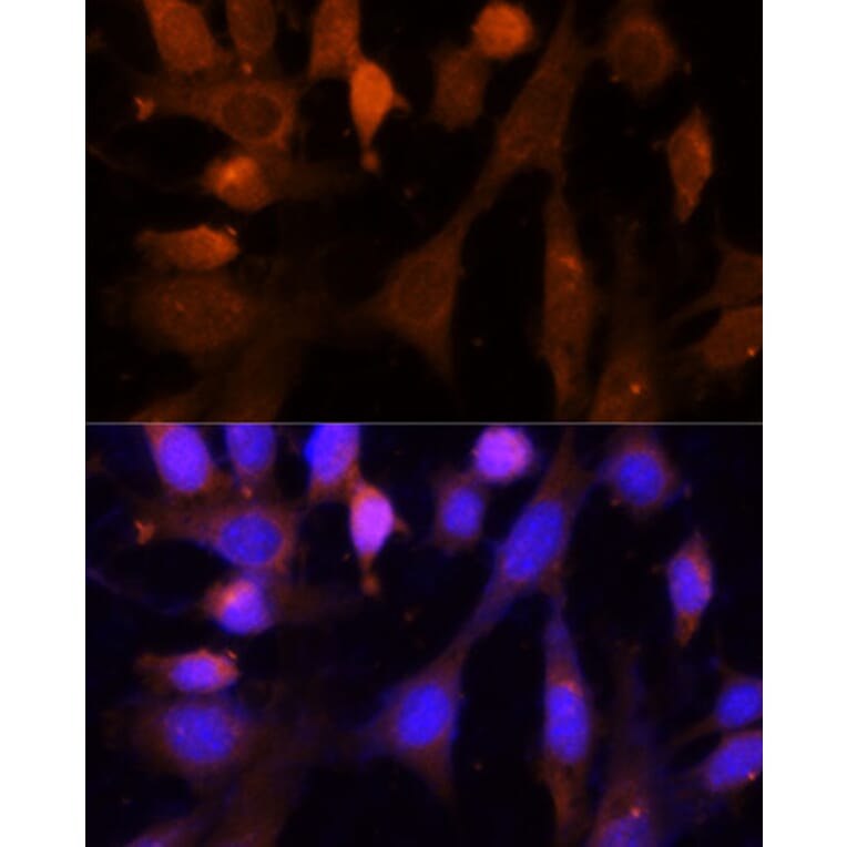 Immunofluorescence - Anti-VPS26 Antibody (A89653) - Antibodies.com