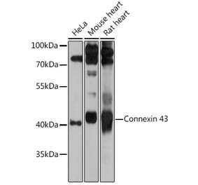 Western Blot - Anti-Connexin 43 / GJA1 Antibody (A89654) - Antibodies.com