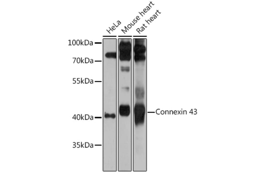 Western Blot - Anti-Connexin 43/GJA1 Antibody (A89654) - Antibodies.com