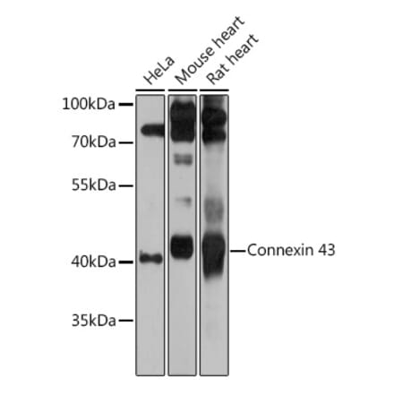 Western Blot - Anti-Connexin 43 / GJA1 Antibody (A89654) - Antibodies.com