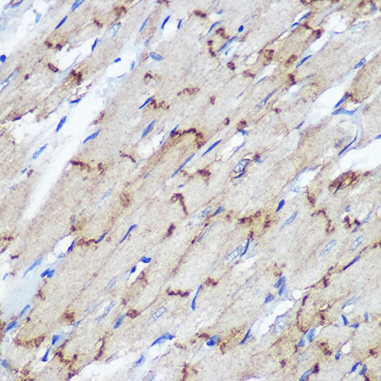 Immunohistochemistry - Anti-Connexin 43/GJA1 Antibody (A89654) - Antibodies.com