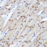 Immunohistochemistry - Anti-Connexin 43/GJA1 Antibody (A89654) - Antibodies.com