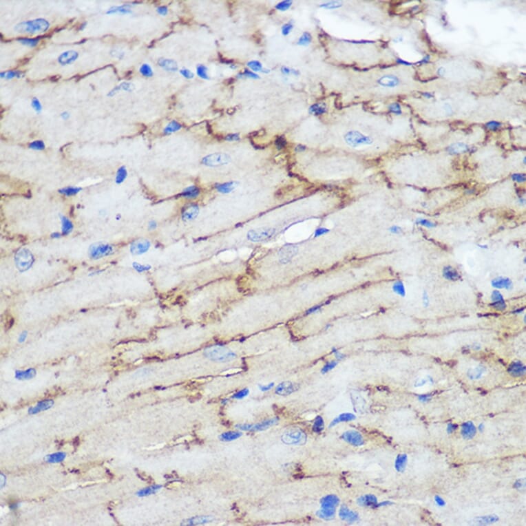 Immunohistochemistry - Anti-Connexin 43/GJA1 Antibody (A89654) - Antibodies.com
