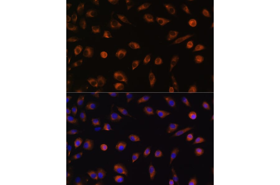 Immunofluorescence - Anti-Connexin 43/GJA1 Antibody (A89654) - Antibodies.com