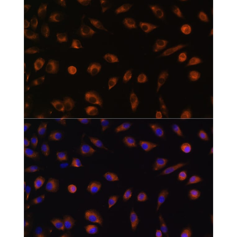 Immunofluorescence - Anti-Connexin 43/GJA1 Antibody (A89654) - Antibodies.com