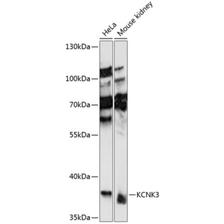 Western Blot - Anti-KCNK3 / TASK1 Antibody (A89655) - Antibodies.com