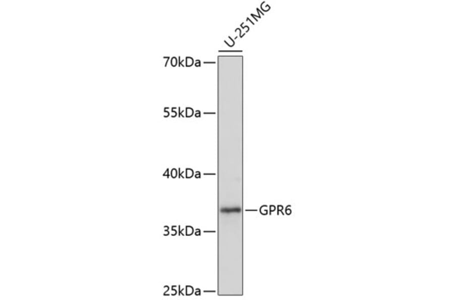 Western Blot - Anti-GPCR GPR6 Antibody (A89656) - Antibodies.com