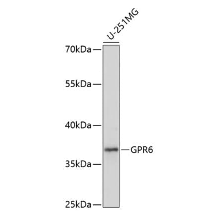 Western Blot - Anti-GPCR GPR6 Antibody (A89656) - Antibodies.com