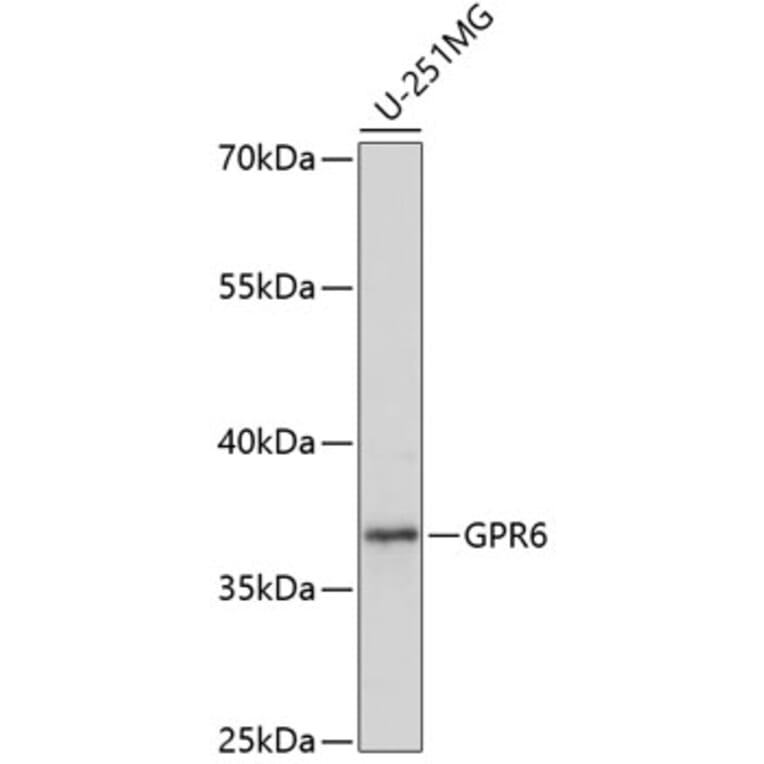 Western Blot - Anti-GPCR GPR6 Antibody (A89656) - Antibodies.com
