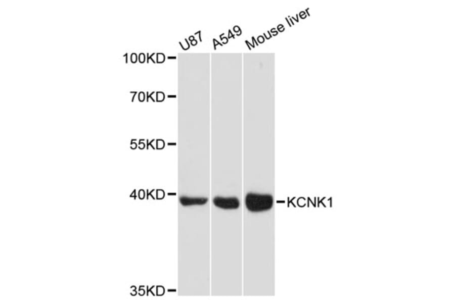 Western Blot - Anti-KCNK1 Antibody (A12835) - Antibodies.com