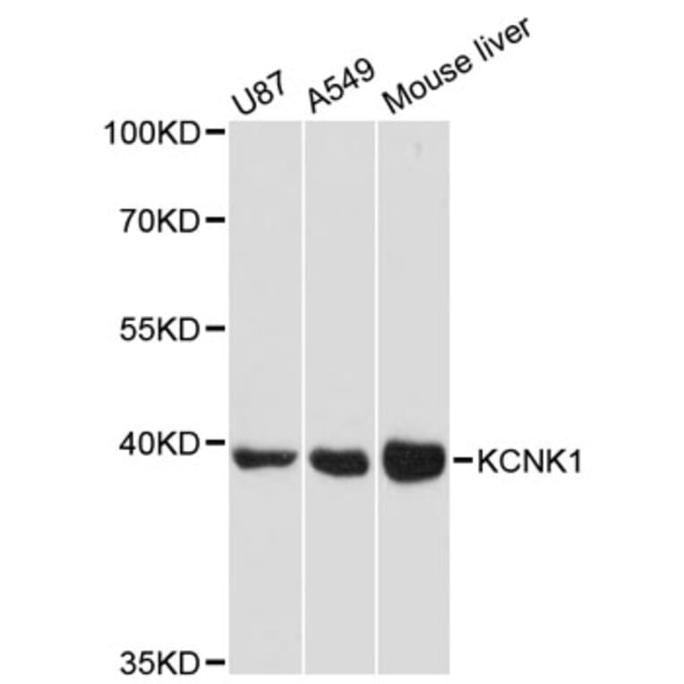 Western Blot - Anti-KCNK1 Antibody (A12835) - Antibodies.com