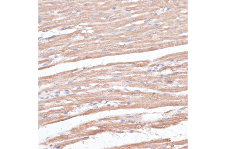 Immunohistochemistry - Anti-KCNK1 Antibody (A12835) - Antibodies.com