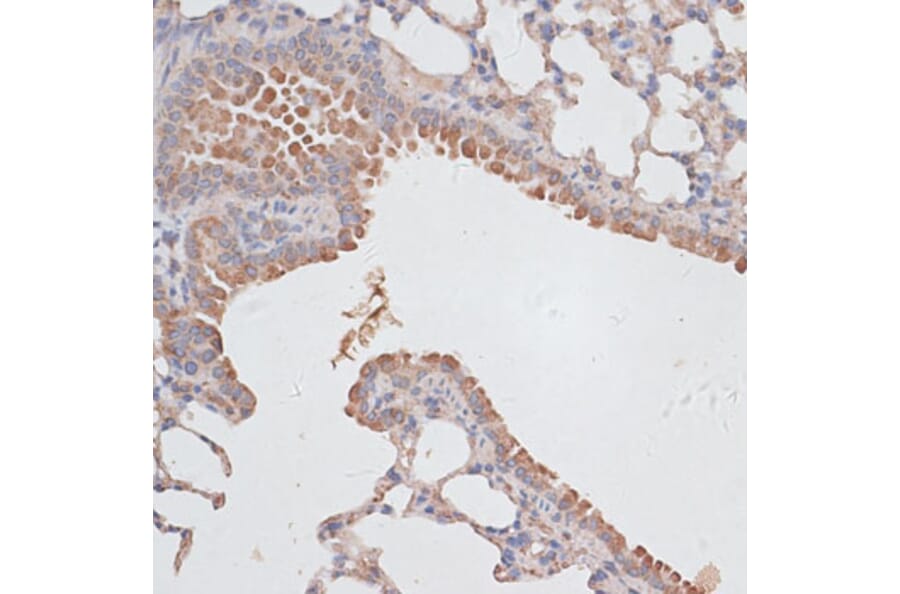 Immunohistochemistry - Anti-KCNK1 Antibody (A12835) - Antibodies.com