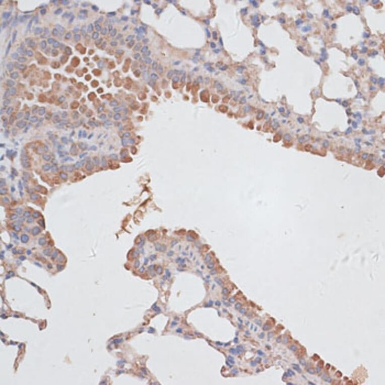 Immunohistochemistry - Anti-KCNK1 Antibody (A12835) - Antibodies.com