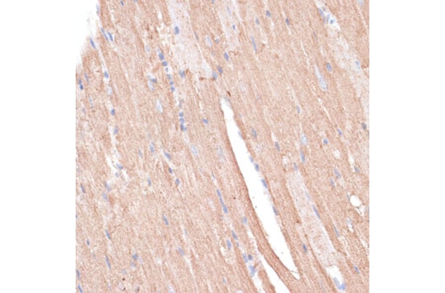 Immunohistochemistry - Anti-KCNK1 Antibody (A12835) - Antibodies.com